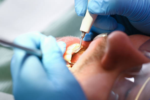 Best Pediatric Emergency Dentist in Kenmore, WA