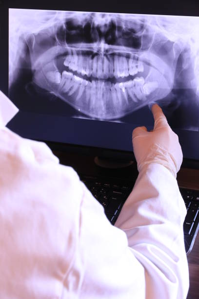 Best Emergency Broken Tooth Repair in Kenmore, WA