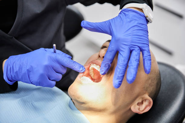 Best Emergency Treatment for Toothache in Kenmore, WA