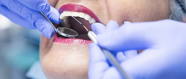Best Emergency Root Canal Treatment in Kenmore, WA